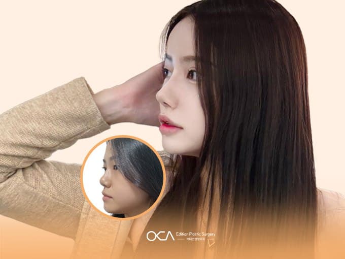 Edition Plastic Surgery Korea Clinic